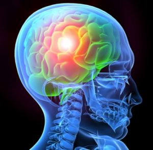 lawyers for traumatic brain injury in Virginia
